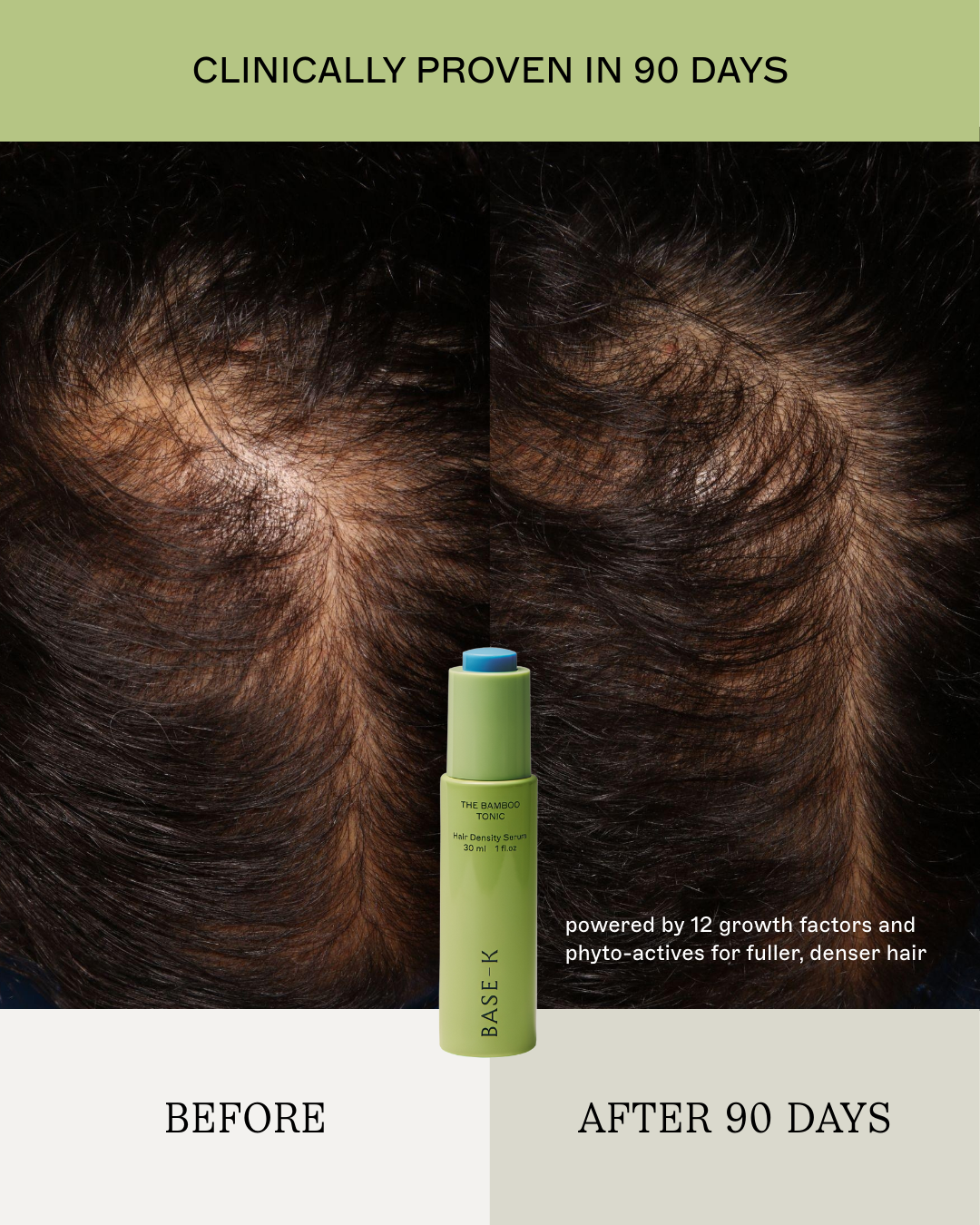 Rosemary Hair Density Serum | Bamboo Hair Tonic | BASE-K