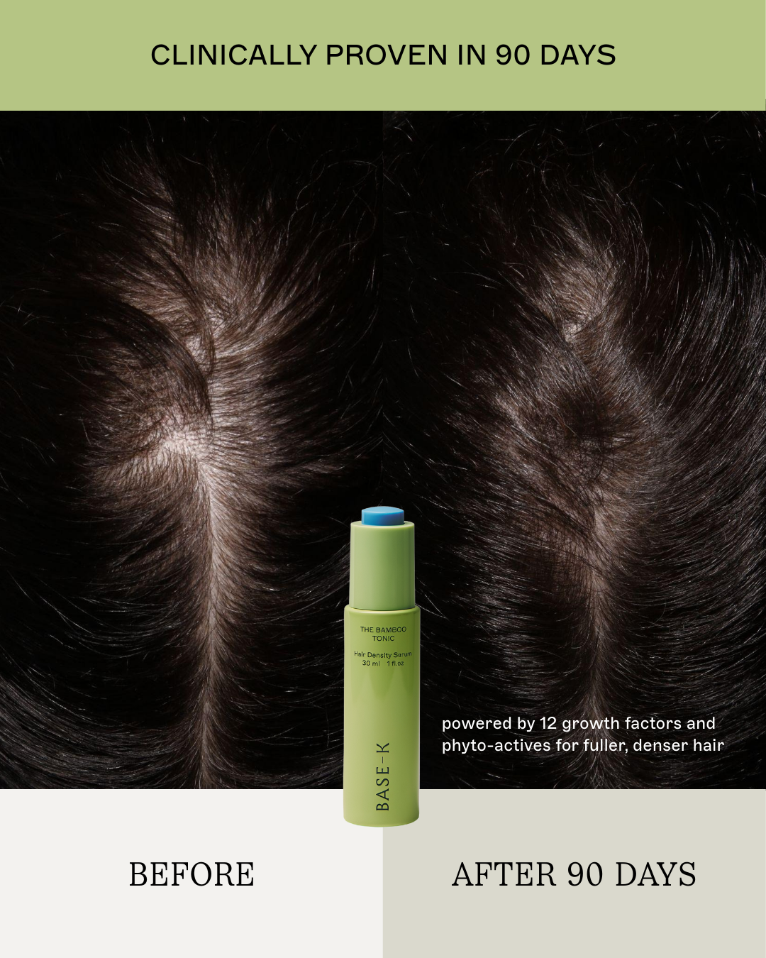 The Scalp Facial™ Ritual - Scalp Rejuvenation Essentials