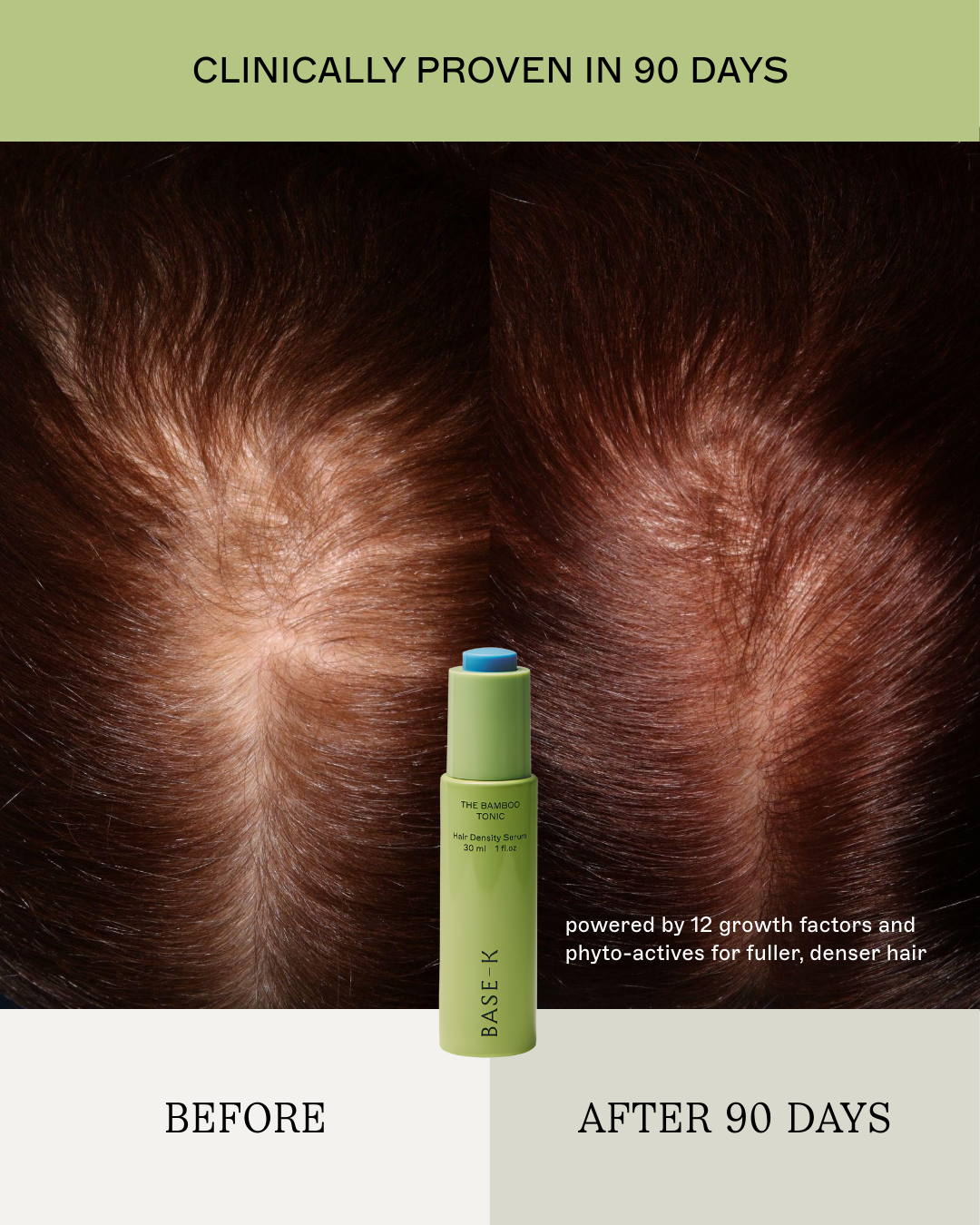 The Scalp Facial™ Ritual - Scalp Rejuvenation Essentials