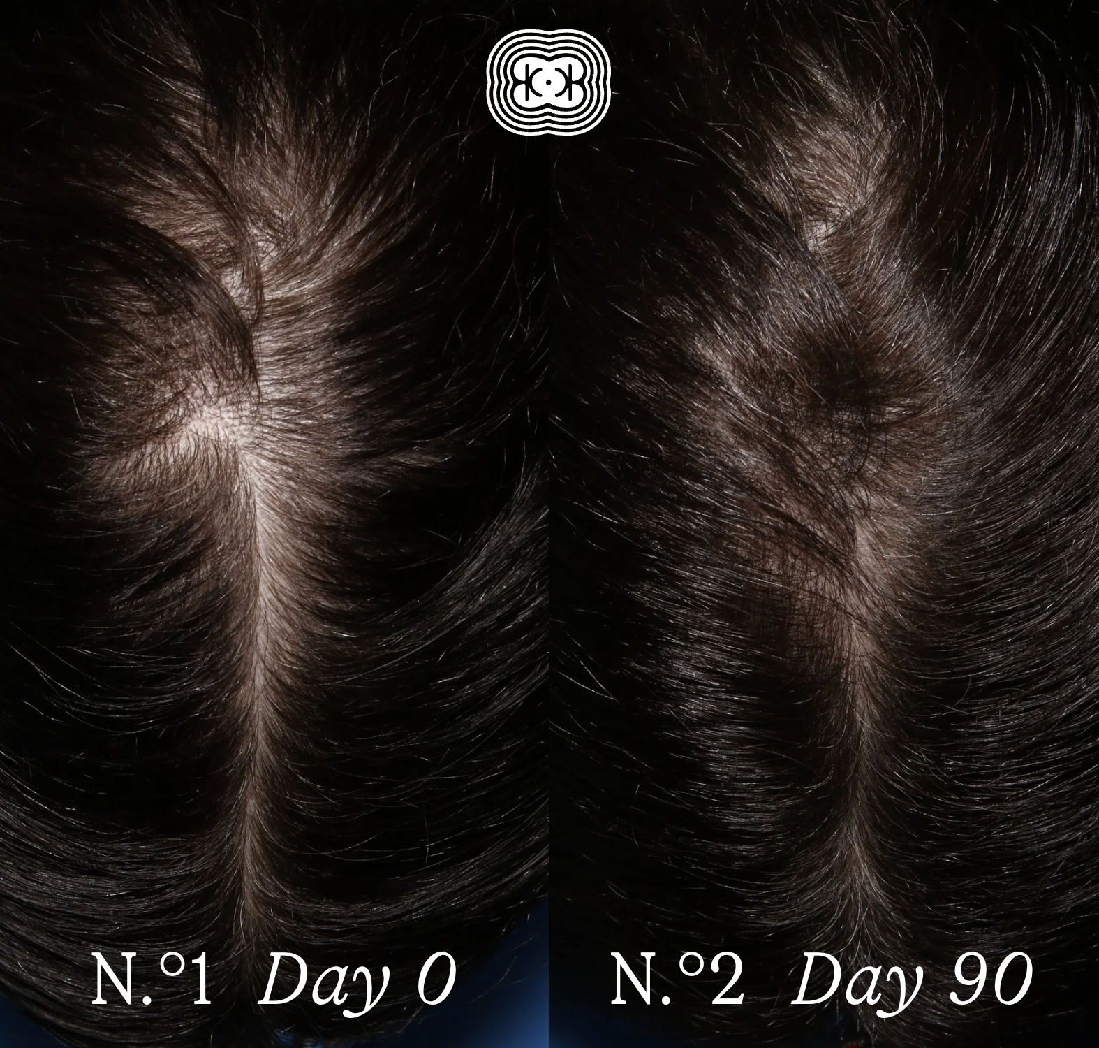 The Scalp Facial™ Ritual - Scalp Rejuvenation Essentials