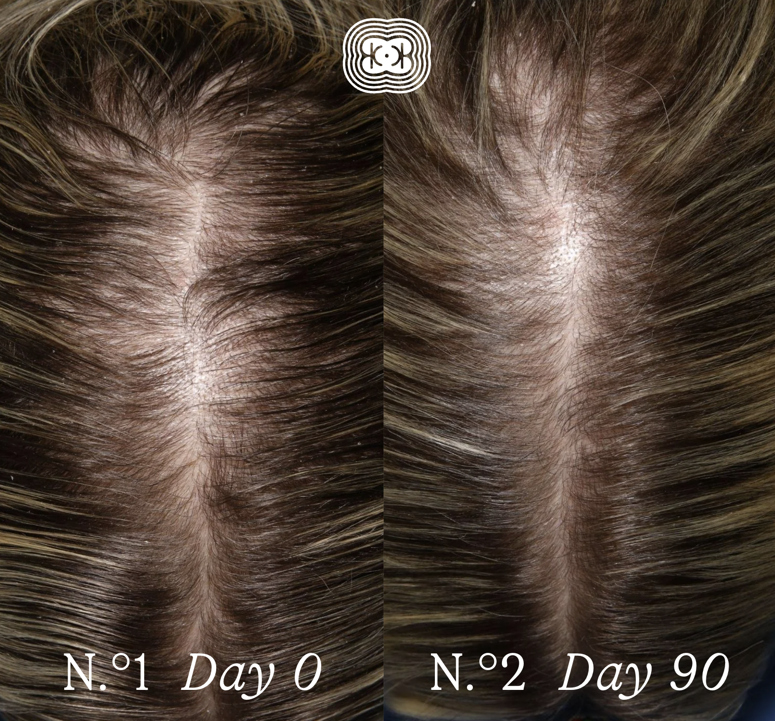 The Scalp Facial™ Ritual - Scalp Rejuvenation Essentials