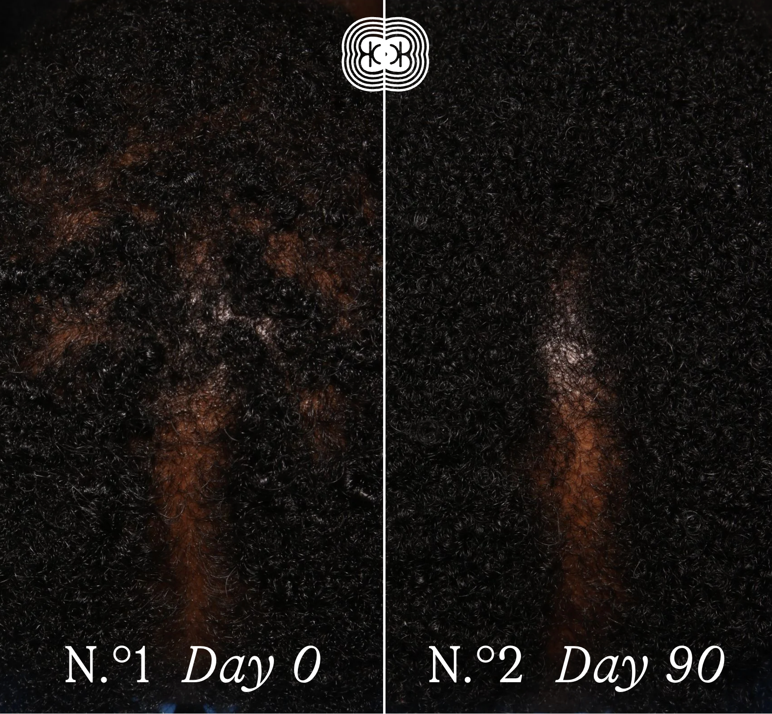 The Thickening Starter Ritual - Daily Thickening Essentials