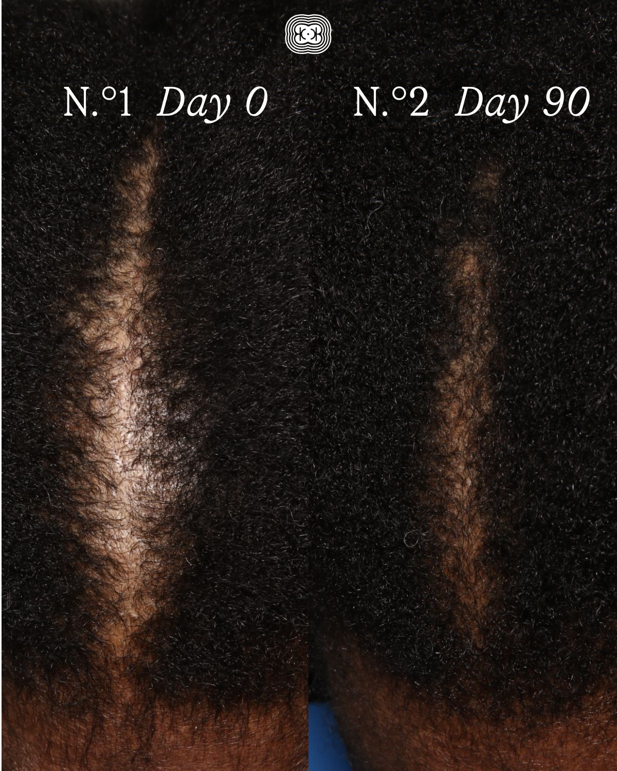 The Scalp Facial™ Ritual - Scalp Rejuvenation Essentials