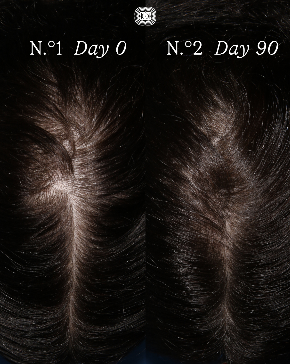 The Scalp Facial™ Ritual - Scalp Rejuvenation Essentials