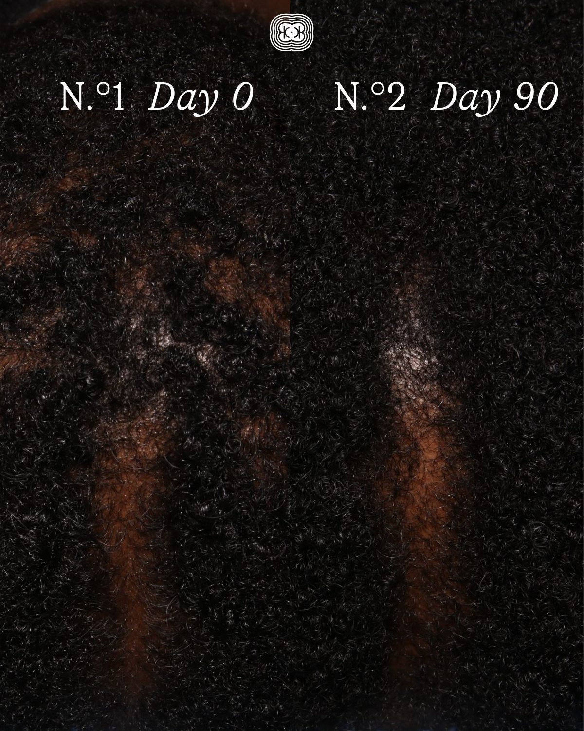 The Scalp Facial™ Ritual - Scalp Rejuvenation Essentials